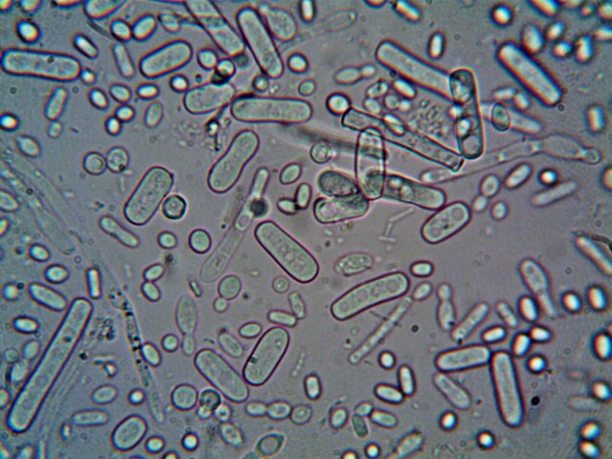 bacteria under a microscope